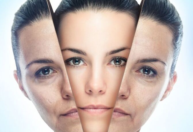 عملية القضاء على التغيرات المرتبطة بالعمر في جلد الوجه